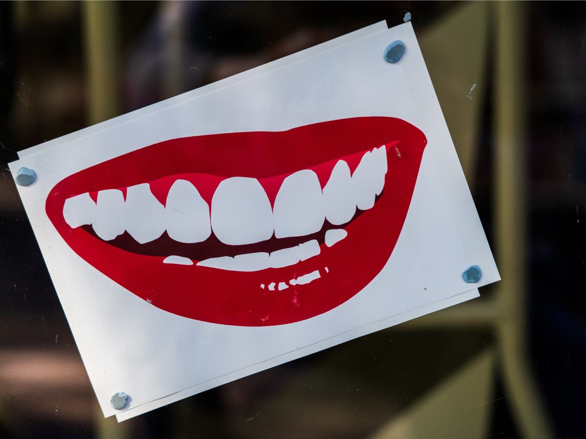 Зубы мудрости: почему у одних они есть, а у других - нет